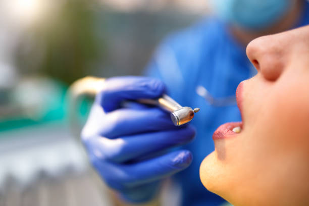 Best Teeth Whitening  in Bel Nor, MO